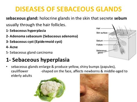 Dermatology Disorders Of Sebaceous And Sweat Glandsdrfaraydwn
