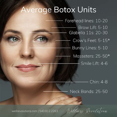 How Many Units Of Botox® Do I Need — Wellness Revolution