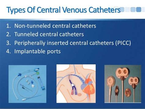 3 Types Of Vascular Access Ports Used In Hemodialysis
