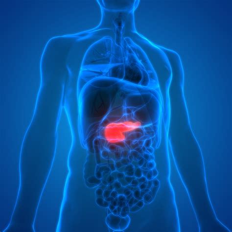 Pancreatic cancer refers to tumors that start in the cells of the pancreas, an organ located behind your stomach that helps you digest food. 10 Things You Need to Know About Pancreatic Cancer