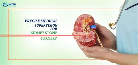 When Should Kidney Stones Be Removed