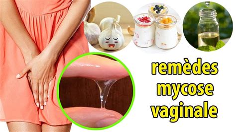 Top Puissants Rem Des Maison Pour La Mycose Vaginale Conseils Youtube My Xxx Hot Girl