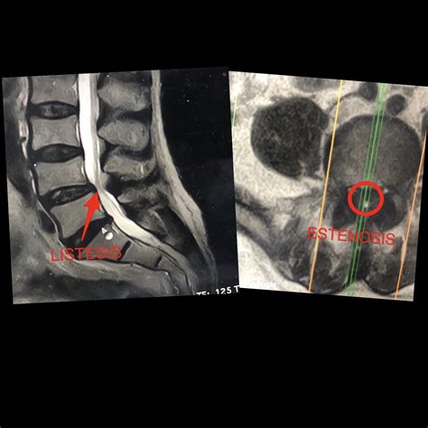 Simple Science: How to Make a Volcano with Kids