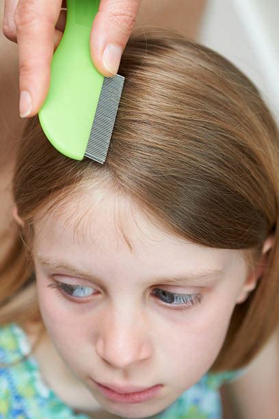 Head Lice Comb Stock Photos Pictures And Royalty Free Images Istock