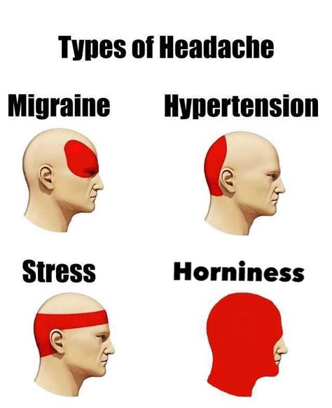 Headache Chart What Does Headache Location Mean