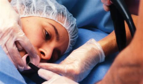 Upper Endoscopy Procedure