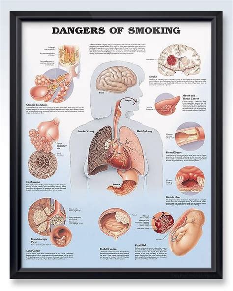 Maybe you would like to learn more about one of these? Pin on Smokers lungs