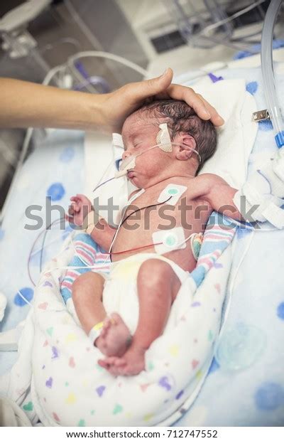 Newborn Premature Baby Nicu Intensive Care Stock Photo Edit Now 712747552