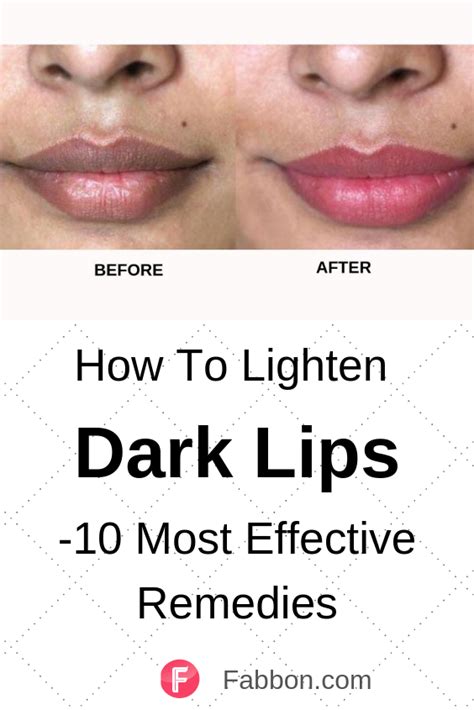 How To Lighten Dark Lips 10 Most Effective Remedies Remedies For