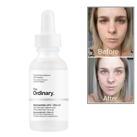 This treatment reduces the appearance of blemishes, redness, enlarged pores, uneven tone, and oily skin. The Ordinary Niacinamide 10% + Zinc 1% 30ML Face Serum Oil ...