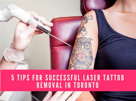 5 Tips For Successful Laser Tattoo Removal In Toronto Hd Beauty