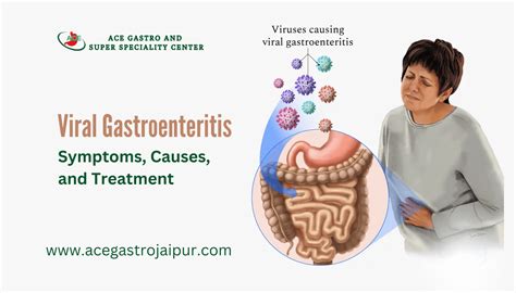 Viral Gastroenteritis Symptoms Causes And Treatment Ace Gastro