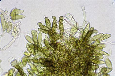 How to use conidia in a sentence. Venturia pyrina - Plant Parasites of Europe