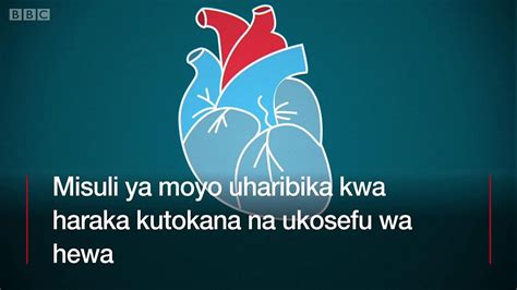 Mambo Muhimu Kuhusu Maradhi Ya Mshtuko Wa Moyo Bbc News Swahili