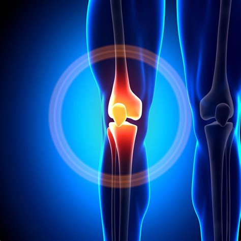 Knee Pain 6 Common Causes Treatment Options