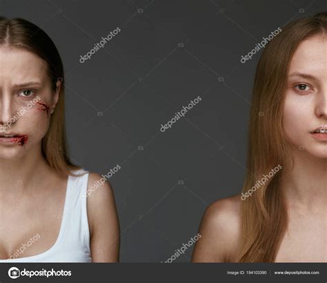Violence Woman Face With Wounds ⬇ Stock Photo Image By © Puhhha