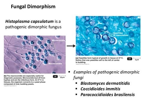 9 bio265 viruses fungi protozoa helminths instructor dr di bonaven…