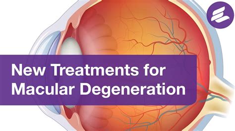 Treatments For Macular Degeneration To Help Preserve Your Vision Youtube