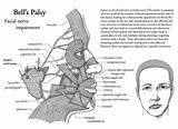 Facial Muscle Exercises For Bell''s Palsy Photos