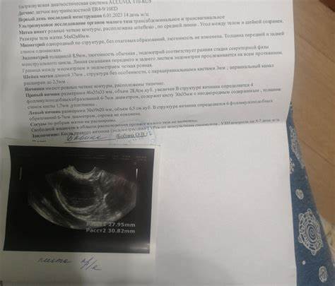 Киста в печени диета лечение Киста яичника под вопросом - Вопрос гинекологу - 03 Онлайн Киста яичника под вопросом - Вопрос гинекологу - 03 Онлайн Киста в печени диета лечение