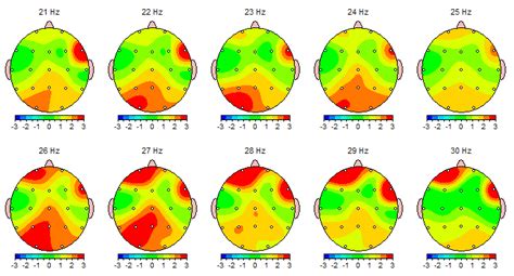 Robison explains in switched on: The Asperger's brain in colour - Planet Autism Blog