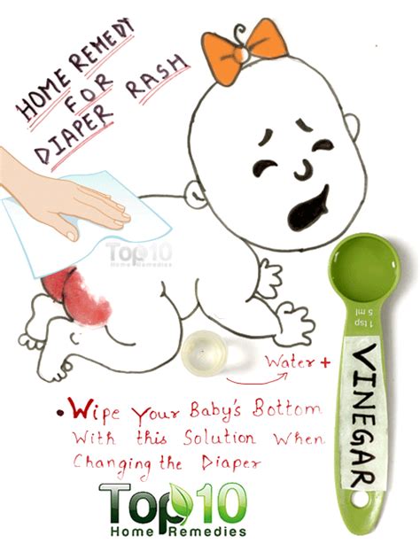 Diaper Rash Causes Prevention And Home Remedies With Images Baby