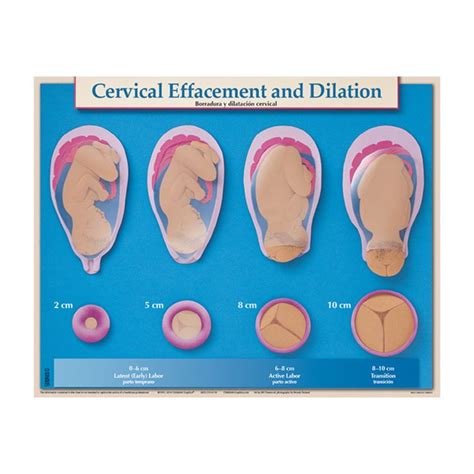 Cervical Effacement And Dilation Chart Cervical Effacement Natural