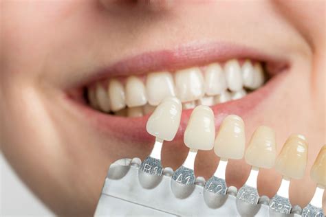 Dental Bonding vs. Veneers: What's Right for You?