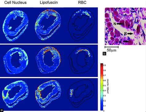 The Spatial Distribution Of Cell Nucleus Lipofusin And