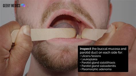 Oral Cavity Examination Osce Guide Geeky Medics
