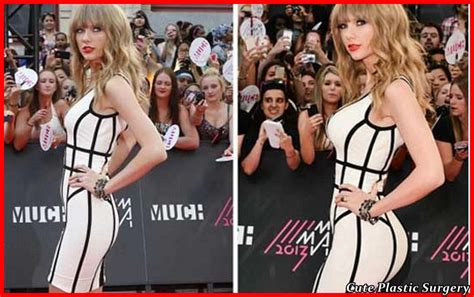 Taylor Swift Breast Implants Nose Job Plastic Surgery