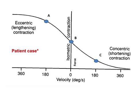 Eccentric contraction refers to muscle action in which the muscle force yields to the imposed load. Solved: A. Which ONE Of The Following Statements Regarding ...