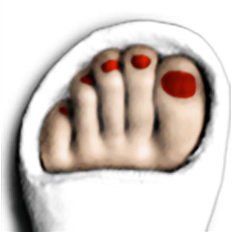 toe with red nail polish on a plaster cast toe castworks