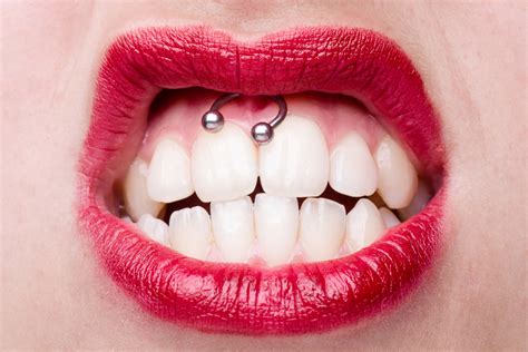 Oral Piercings And Oral Risk What They Dont Tell You At The Piercing Parlour Absolute