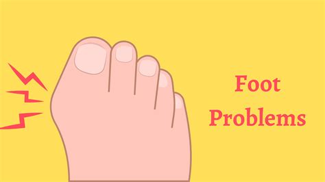 The Most Common Foot Problems And How To Prevent Them Healthnord
