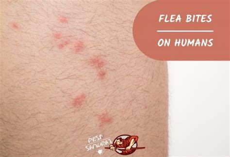 What Does A Flea Bite Look Like On A Dog