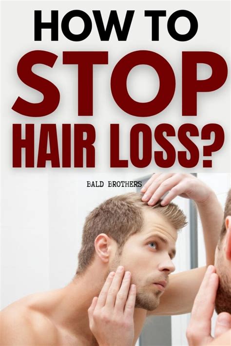 How To Stop Hair Loss In Men Is It Even Possible The Bald Brothers