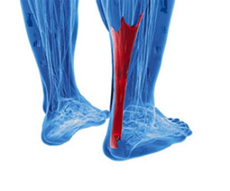 Common Achilles Tendon Injuries