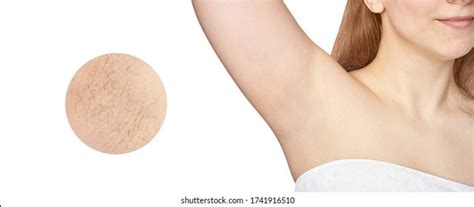 Girl Underarm White Woman Armpit Before Foto Stok 1767288731 Shutterstock