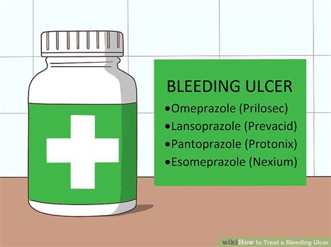 How To Treat A Bleeding Ulcer 14 Steps With Pictures Wikihow