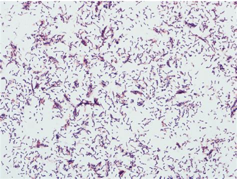 Gram Positive Rods From Pure Culture Download