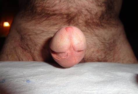 Frenulum For Only Uncut 22 Pics Xhamster