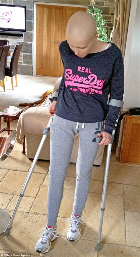 Sarah Dransfield Has Leg Amputated After Leg Sprain Turned