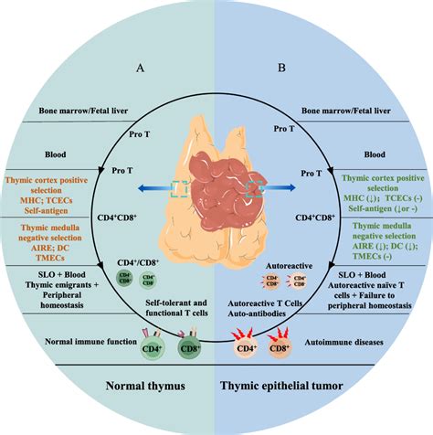 Naïve T cell development in the normal thymus and thymoma A A healthy Download Scientific