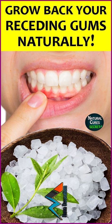 How To Treat Receding Gums At Home Home Remedies For Gum Disease How