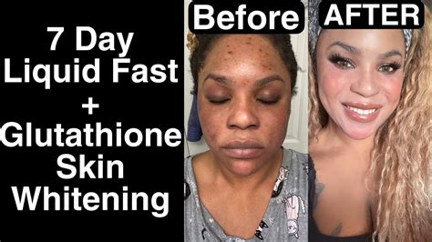 Permanent Skin Whitening 7 Day Liquid Fast Heres What Happened Youtube