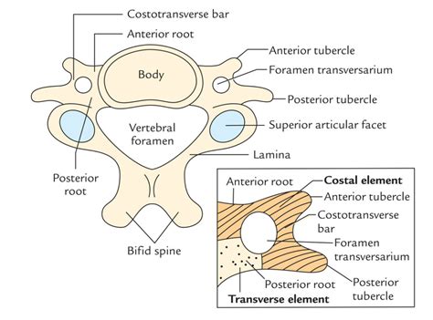 Cervical Transverse Process Fracture