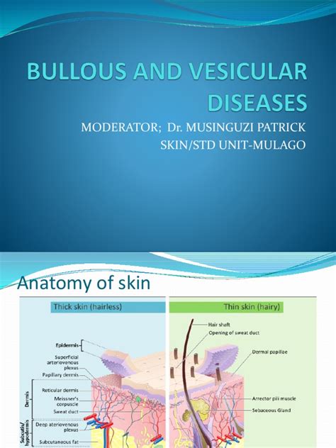 Bullous And Vesicular Diseases Pptx Edited 1 Pdf