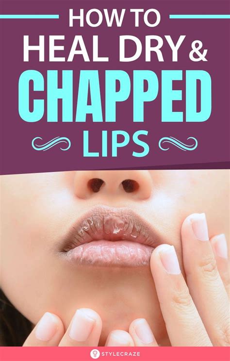 If You Have Dry And Chapped Lips This Is How You Heal Them Chapped