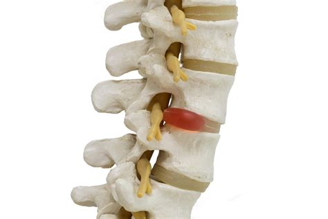 Find and reach comprehensive spine and sports center's employees by department, seniority, title, and much more. Chiropractor in Middle River Offers Treatment for ...